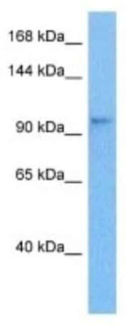 JIP2 Rabbit anti-Human, Polyclonal, Novus Biologicals:Antibodies:Primary